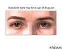 Signs of drug use