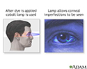 Fluorescent eye test
