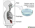 Culture of gastric tissue biopsy