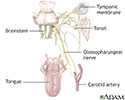 Glossopharyngeal neuralgia