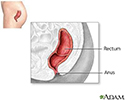 Rectum