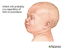 Infant test/procedure preparation