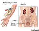 Kidney function tests