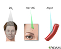 Laser therapy