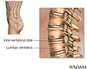 Lumbar vertebrae
