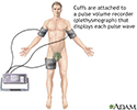 Plethysmography
