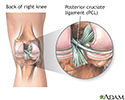 Ligamento cruciforme posterior de la rodilla
