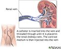 Renal veins