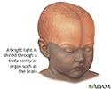 Infant brain test