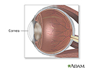 Cornea