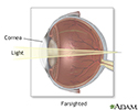 Farsighted