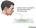Sputum test