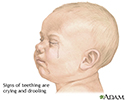 Teething symptoms