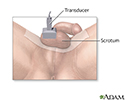 Testicular ultrasound