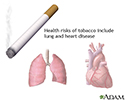Tobacco health risks