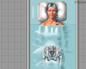 Osteoporosis