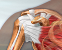 Rotator cuff problems