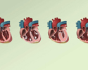 Cardiomyopathy overview
