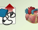 Cardiac hypertension hypertrophy