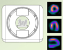 Nuclear heart scan overview